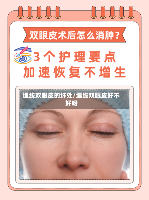 埋线双眼皮的坏处/埋线双眼皮好不好呀-第3张图片