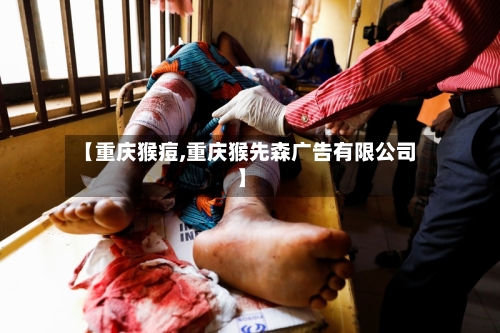 【重庆猴痘,重庆猴先森广告有限公司】